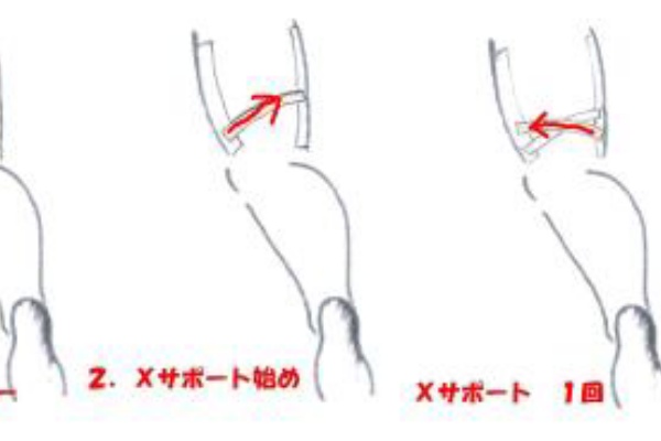 肉離れテーピングの巻き方と治療法 肉離れの テーピングの巻き方