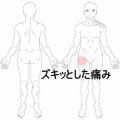歩行時にズキッとする股関節前側の痛み　登別室蘭すのさき鍼灸整骨院　症例報告