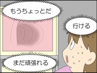 大腸の中にいるポリープ④