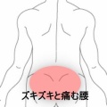 重量物を持ち上げた際に生じた電撃様の急性腰痛 　登別室蘭すのさき鍼灸整骨院　症例報告