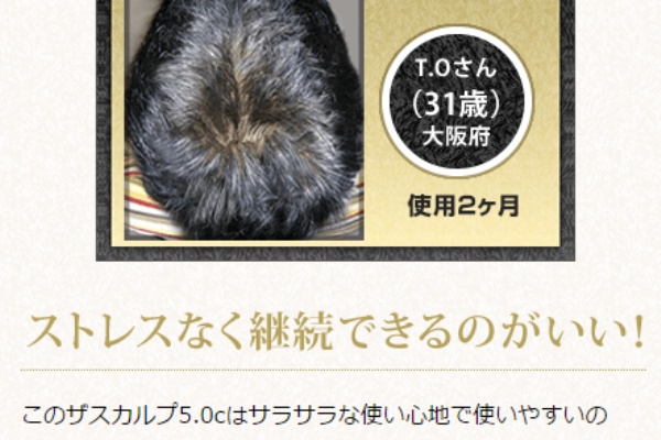 彼氏の髪が薄い スカスカ薄毛をフサフサに改善した方法 彼氏髪薄い