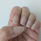 イブランス19～21クール副作用　フェソロデックス