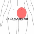 起床時から始まった右腰のズキズキ痛と日常動作の制限　登別室蘭すのさき鍼灸整骨院　症例報告