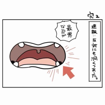 穴2