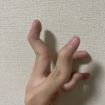 指エグい曲がり方するんだけど自分だけ？（※画像あり）