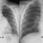 こどもの病気・おとなの病気