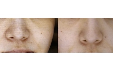 『ショッピングリフト』の画像