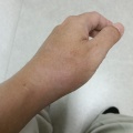 ヤケドのケガはまだ完全に皮膚が再生しておらず薬は塗らなくてはいけない状態ですが包帯を巻かなくてもよくなりました！お盆明けからお弁当作り再開できたらと思います。