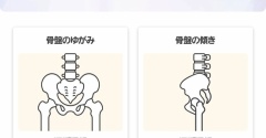 スマホで測れる？！花王のmy Symmetryで体の歪みを調べてみた