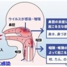 GW明けに急増した謎の風邪