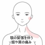 『顎の緊張を伴う左頚背部の張り感と首の動き制限　 登別室蘭すのさき鍼灸整骨院　症例報告』の画像