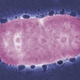 『歯周菌と関節炎の関係』の画像