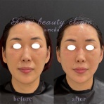 ～Dr.Fumiの美容Blog～