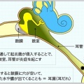 中耳炎抗生物質適応