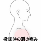 『投球時の肩のツーンとした痛み 　登別室蘭すのさき鍼灸整骨院　症例報告』の画像
