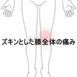 『歩行困難になった左膝全体のズキンとした痛みと屈曲制限 　登別室蘭すのさき鍼灸整骨院　症例報告』の画像
