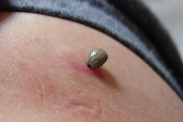 マダニ Sinの徘徊記録