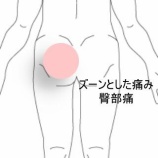 『歩行時に増悪する左臀部の鈍痛と腰痛　登別室蘭すのさき鍼灸整骨院　症例報告　』の画像