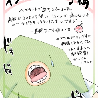 インプラント手術🦷