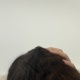 【悲報】ワイ、猫に襲われる