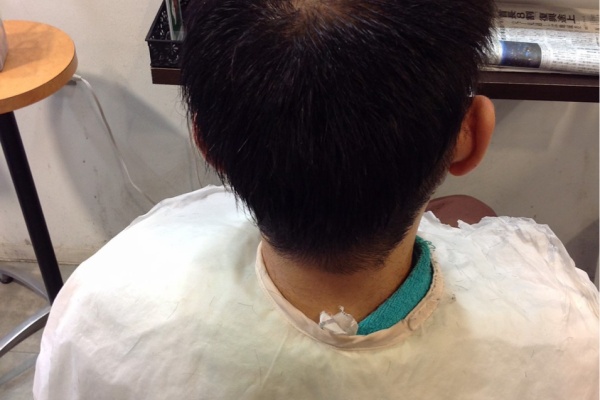 神戸 紫光美容室 薄毛女子