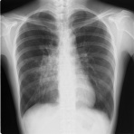 こどもの病気・おとなの病気