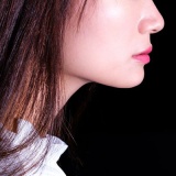 【画像あり】女子、整形に成功「この形の鼻が全女子の理想だと思う！！」⇒！
