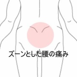 『ギックリ腰後の座位時の姿勢の傾きと反る動きの制限 登別室蘭すのさき鍼灸整骨院　症例報告』の画像
