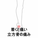 ランニングで地面に足を着くと痛む右踵外側の痛み　登別室蘭すのさき鍼灸整骨院　症例報告
