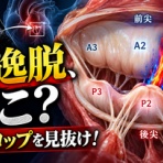 【1記事3分】超音波検査士けんしんのエコーノート