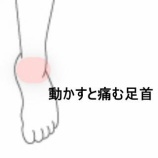 『足首捻挫による内外果の圧痛と可動域制限 　登別室蘭すのさき鍼灸整骨院　症例報告』の画像