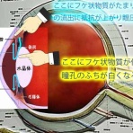 ある奈良県の眼科医が目について書いたブログ