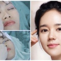 Nhấn mí mắt bị nhiễm trùng