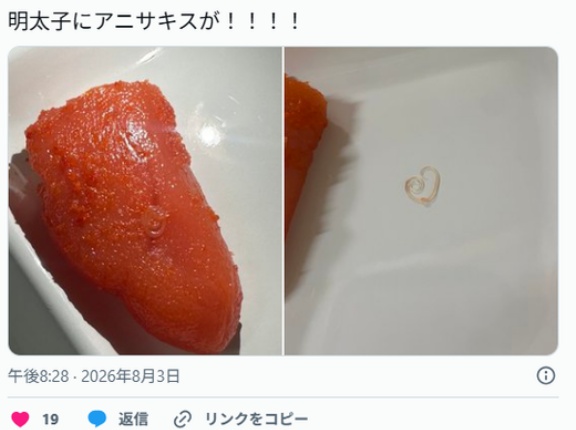 スーパーで買った明太子から「アニサキスが！」