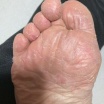 �����Ƕ�θ��ݤ��ﳲ�ʣ�������ǯ�������Ⱦ��