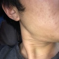 禁煙開始5週間目の変化