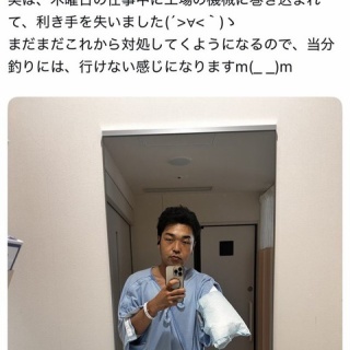 『【画像】工場勤務X民、腕が潰されてシャンクスになってしまう』の画像