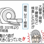 腎のう胞は問題無し