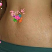 本気で肉割れ 妊娠線を消したい人に朗報 出来てしまった妊娠線がキレイになるクリームがあるんです 私の好きなもの