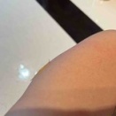 去年も腫れたなぁ