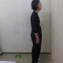 Iさんの姿勢矯正