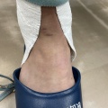 本日も、スポーツ選手　早期復帰へ
