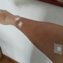 【間質性肺炎】外来診療31回目