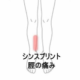 『ソフトテニス中に発症したシンスプリントの痛みと圧痛　登別室蘭すのさき鍼灸整骨院　症例報告　』の画像