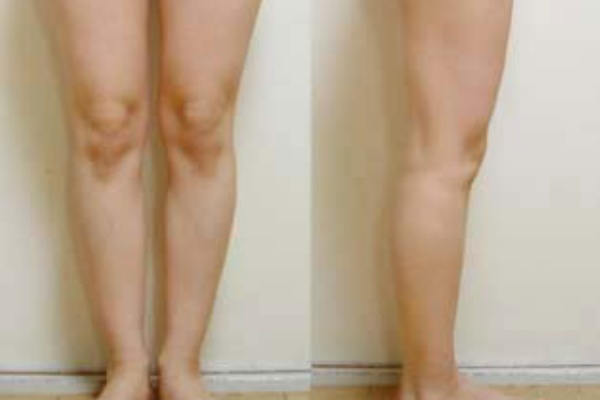 30代の愛されボディプロジェクト 脚痩せ 美脚