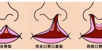 先天性の奇形の赤ちゃんを見ごろしにしたニュースを見た。手術すればいいのにひどすぎる