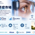眼内圧上昇症市場、2025年42億8,000万米ドルから2035年94億3,000万米ドルへ