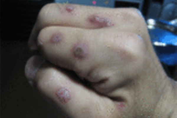 踊ってなんぼ 液体窒素 パート2