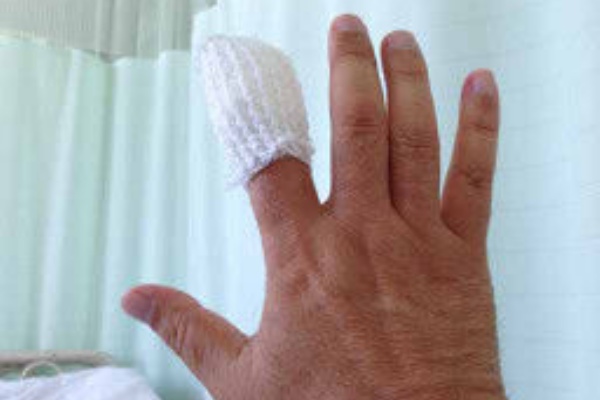 さらに続く ボーエン病 シヌマdeシネマ ハリー東森