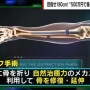 つい最近骨延長手術を受けたツイッタラー、錯乱してしまう…
